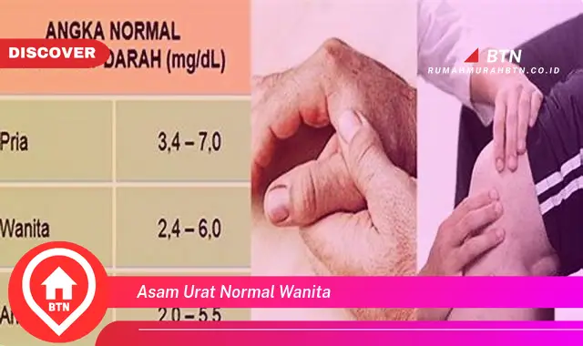 asam urat normal wanita