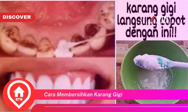 cara membersihkan karang gigi