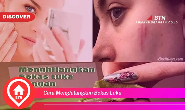 cara menghilangkan bekas luka