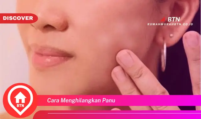 cara menghilangkan panu