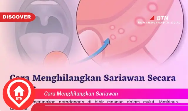 cara menghilangkan sariawan