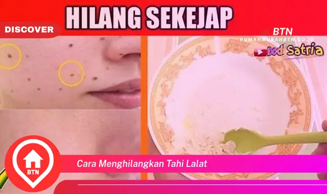 cara menghilangkan tahi lalat