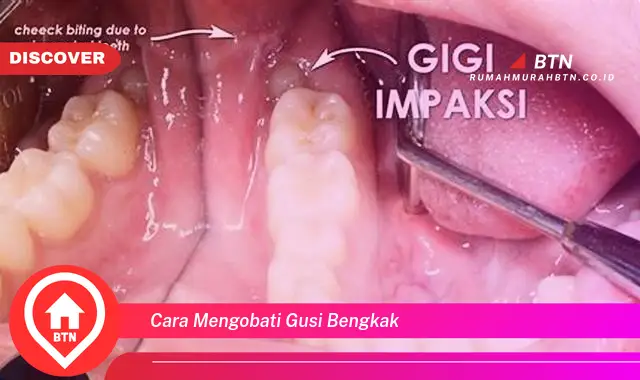 cara mengobati gusi bengkak