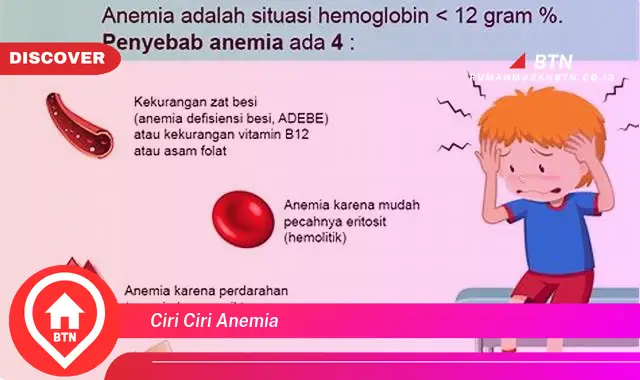 ciri ciri anemia