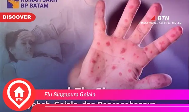 flu singapura gejala