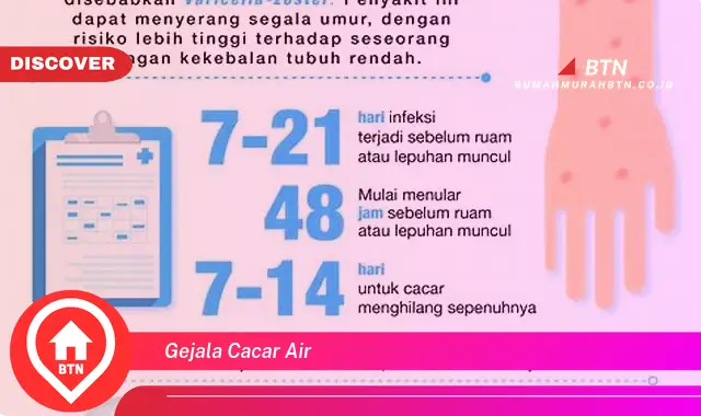 gejala cacar air