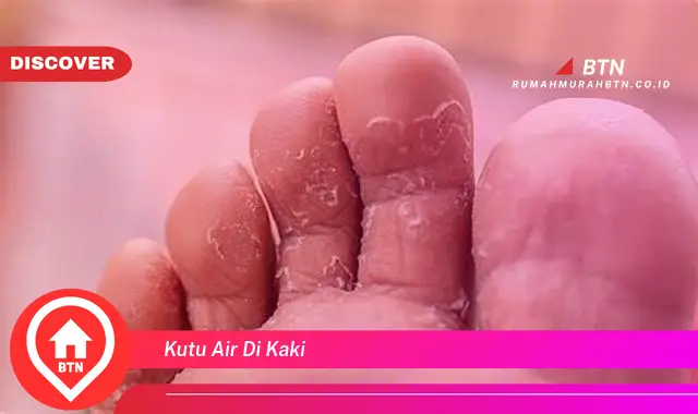 kutu air di kaki