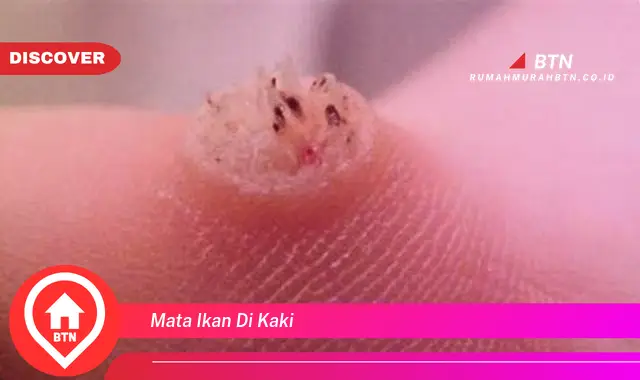 mata ikan di kaki