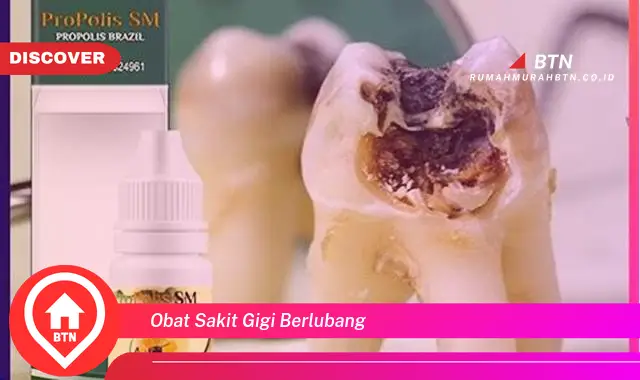 obat sakit gigi berlubang