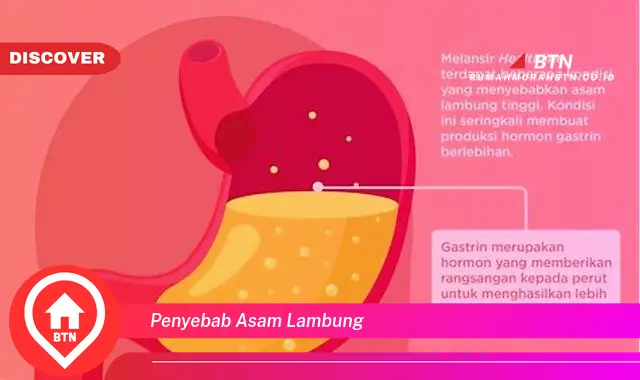 penyebab asam lambung