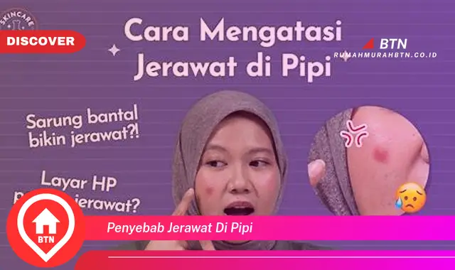 penyebab jerawat di pipi