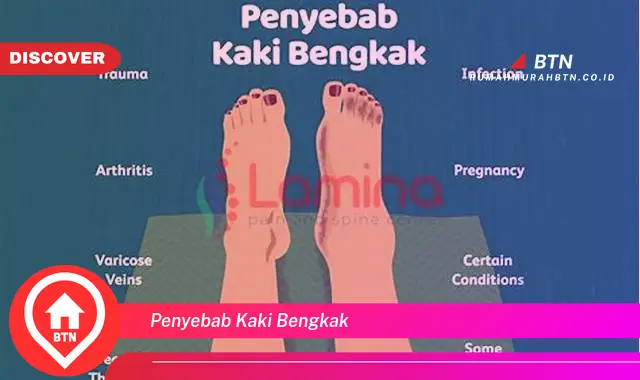 penyebab kaki bengkak