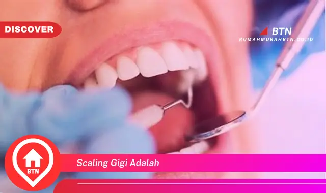 scaling gigi adalah