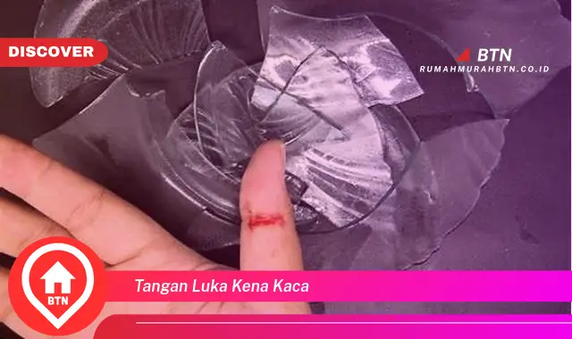 tangan luka kena kaca