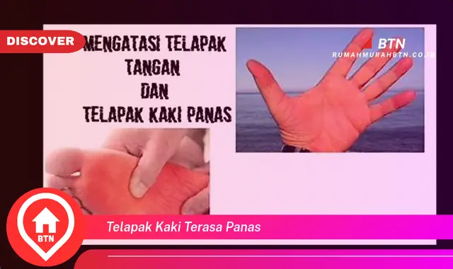 telapak kaki terasa panas