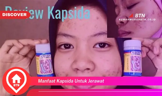 manfaat kapsida untuk jerawat