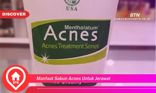 manfaat sabun acnes untuk jerawat