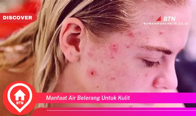 manfaat air belerang untuk kulit