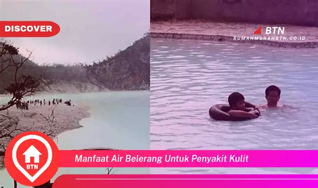 manfaat air belerang untuk penyakit kulit